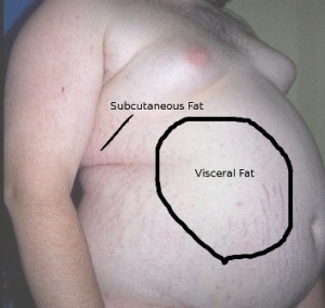 bellyfat belly fat, visceral fat, subcutaneous fat, obesity