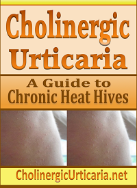 cholinergic urticaria, heat hives, chronic hives, heat allergy