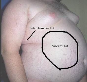 belly fat, visceral fat, subcutaneous fat, obesity